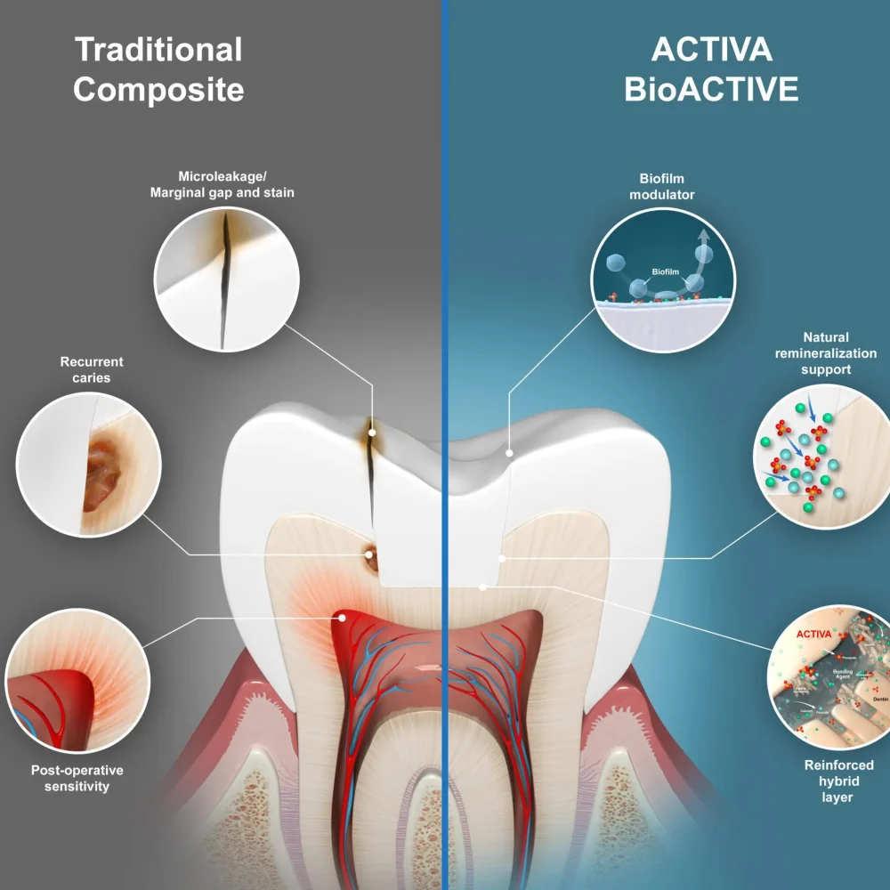 ACTIVA BioACTIVE Bulk Flow