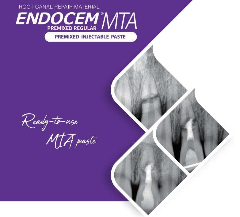 ENDOCEM Premixed Injectable MTA